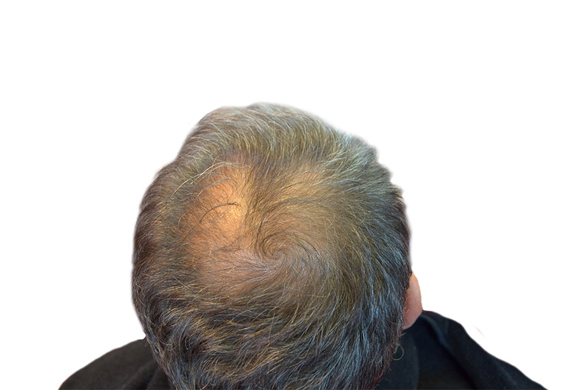Hair Effect Haarfasern